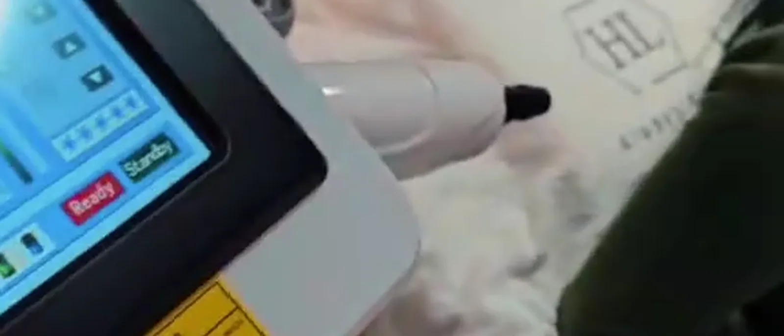 Aparatul de epilare definitivă cu laser folosit la SCP Shine & Style