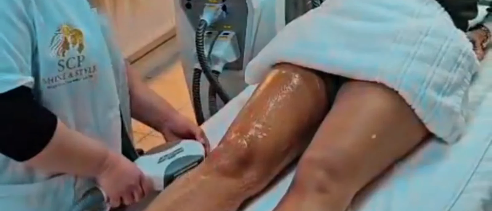 Epilare cu IPL pe corp, la SCP Shine & Style, Baba Novac 9I
